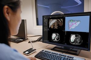 Мировые лидеры представляют свои новейшие разработки на RSNA 2019